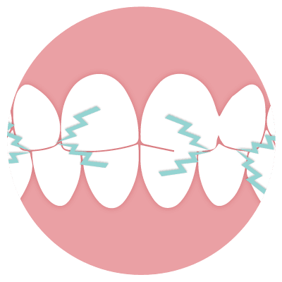 Icono ATM y Bruxismo