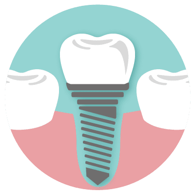 ICONO IMPLANTES DENTALES