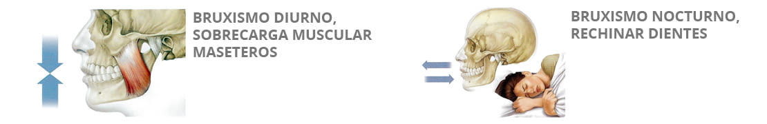 Imagen extraída de la guía ilustrada para pacientes odontológicos de Lacer