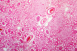 TINCIÓN PARA MICROSCOPÍA - EOSINA 1