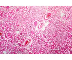 TINCIÓN PARA MICROSCOPÍA - EOSINA